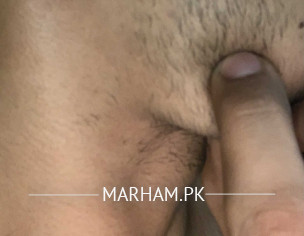 Something Underthechin