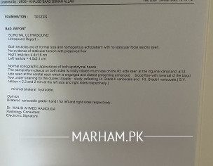 Varicocele And Semen Test