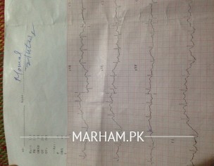 Cardio (Heart) Problem