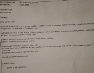 Varicocele In Left Testis