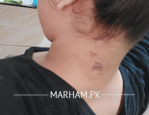 Maybe I Have Psoriasis