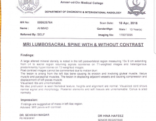 Suspected Malignancy