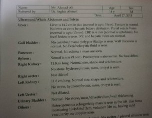 Suspected Malignancy