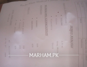 Serem Analysis Test Report