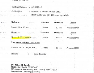 Chest Pain And Sweating