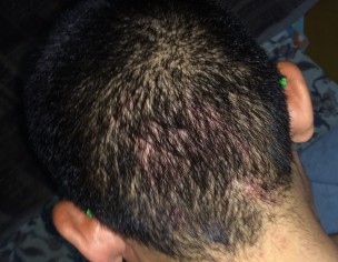 Dermatologist Hair Skin