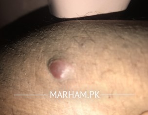 Chahre Or Jism Per Dane