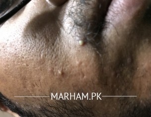 Chahre Or Jism Per Dane