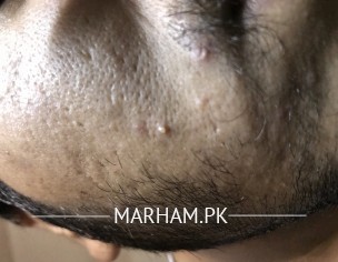 Chahre Or Jism Per Dane