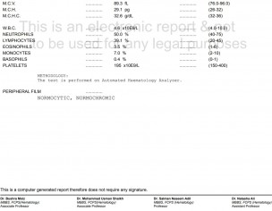 Clomid After Laproscopy