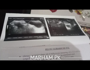 Please Check TVS Scan