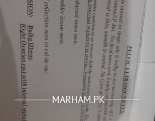 Please Check TVS Scan