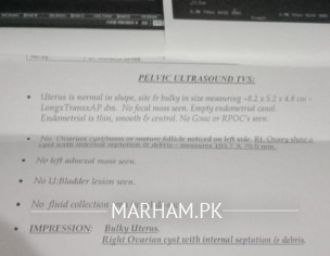 Please Check TVS Scan