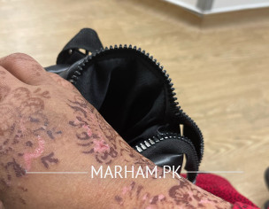 Skin Condition With Mehndi 