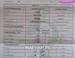 Check The Report Please?