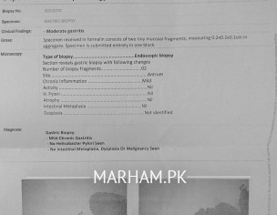 Sleep Problem And GERD