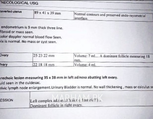 Ovary Dermoid Cyst Laparoscopy (gynaecologist)