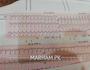 Fast Heart Beta 270 Pulses