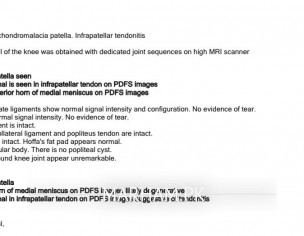Knee Heaviness On Both Sides