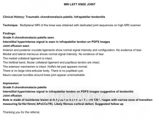 Knee Heaviness On Both Sides