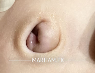 Belly Button