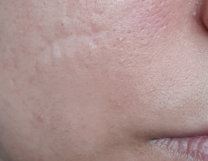 Dermatology