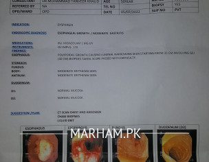 Endoscopy Result