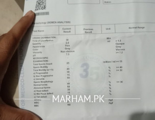 Premature Ejaculation