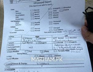 RFT | Value Is Greater Than Normal