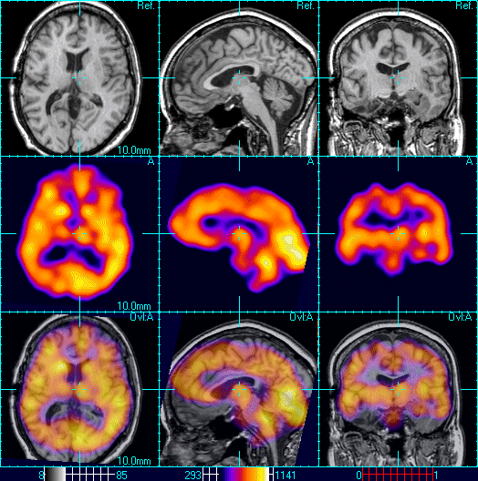 gamma scan.gif