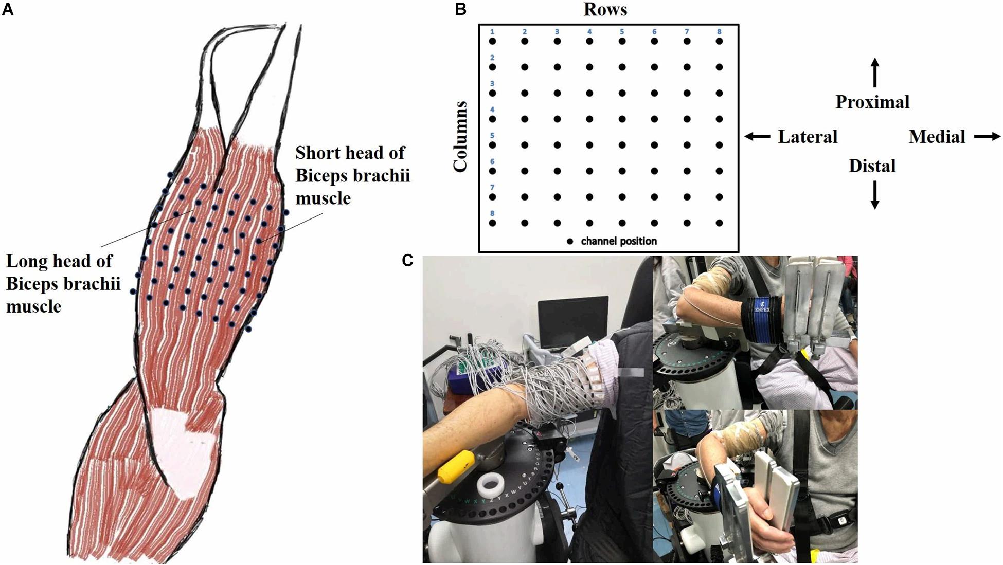 Motion Capture and Muscle Activation Analysis, Frontiers | Increased Muscle Activity Accompanying With Decreased Complexity as Spasticity ...
