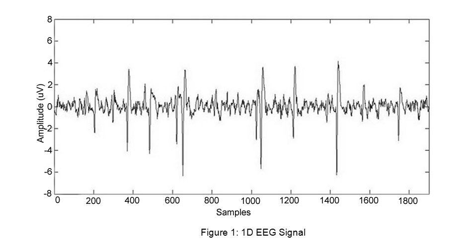 Definition of scalograms, Wavelet Transform for Classification of EEG Signal using SVM and ANN | Biomedical and ...