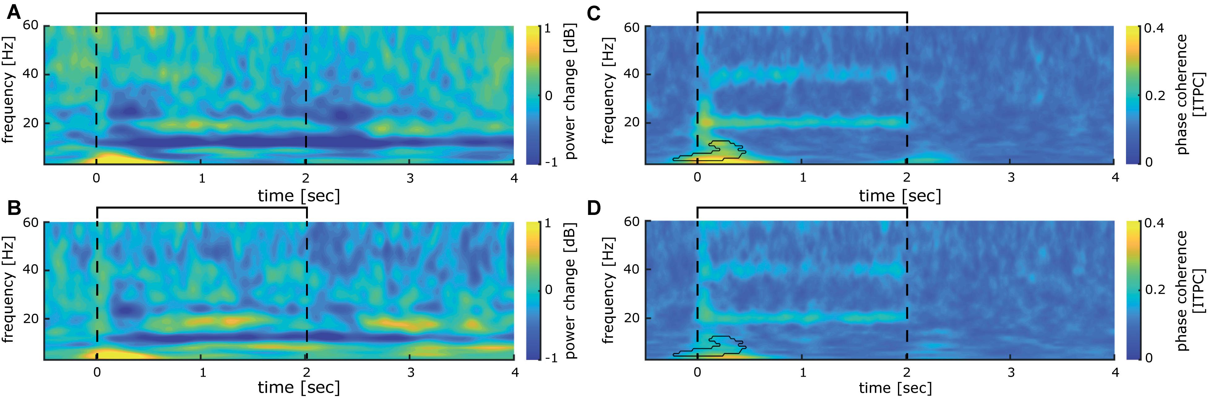 Calculating Steady-State Response for Various Inputs, Frontiers | 20 Hz Steady-State Response in Somatosensory Cortex During Induction of Tactile ...