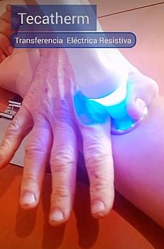 TECATHERM  CEC ( TECARTERAPIA) promo 9500