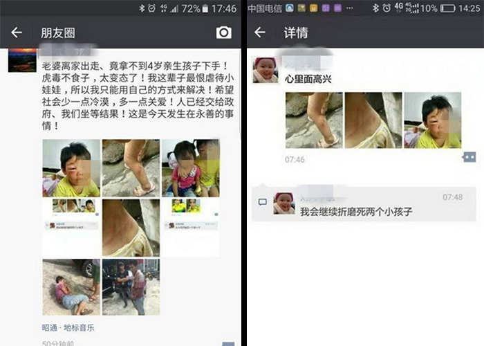 ‘집 나간 아내’ 돌아오게 하려고… 아이들 ‘학대’ 사진 올려 협박한 남성 e1848ce185a6e18486e185a9e186a8 e1848be185a5e186b9e1848be185b3e186b7 1 1 - ‘집 나간 아내’ 돌아오게 하려고… 아이들 ‘학대’ 사진 올려 협박한 남성