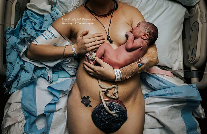 birth-photography-2017-contest-winners-iapbp-1-1