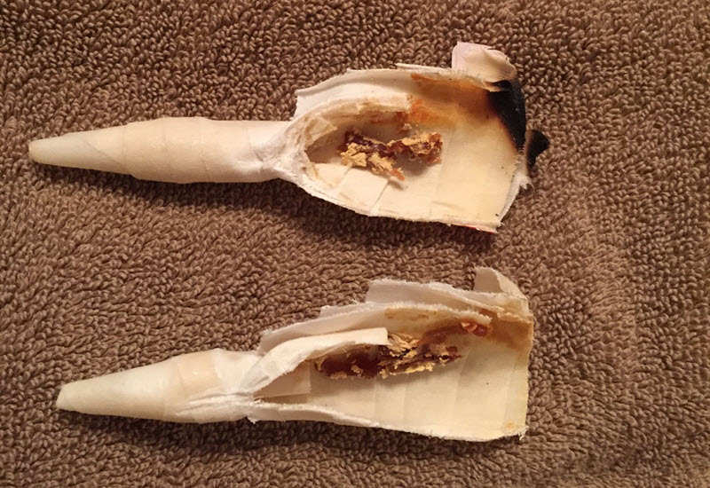 ear wax removal cone