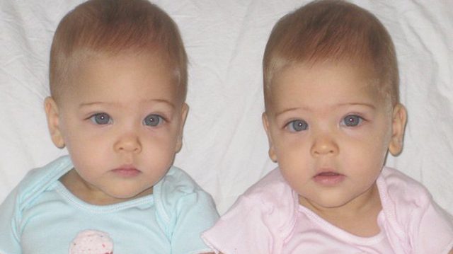 Meet the identical twins born in 2010—now dubbed as ‘the most beautiful girls in the world’