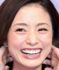 芸能人の歯が綺麗 汚いランキング28人 芸能人は歯が命です Hachi8 ニュース