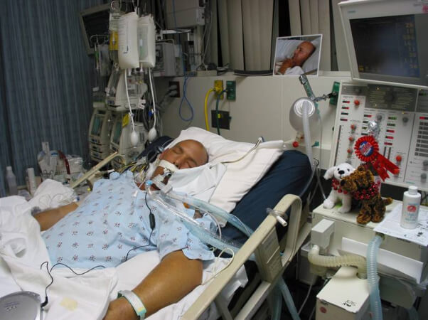 Image result for coma situation