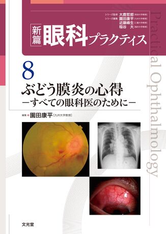 ぶどう膜炎の心得 (新篇眼科プラクティス 8) - 健康/医学