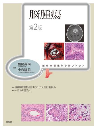 脳腫瘍 | 株式会社文光堂