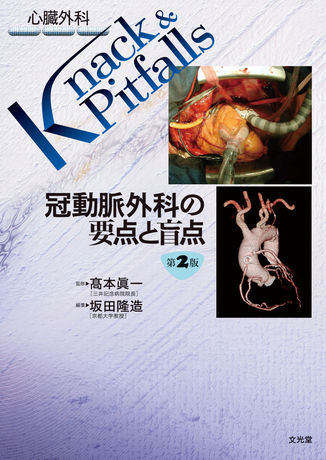 冠動脈外科の要点と盲点（電子版のみ） | 株式会社文光堂