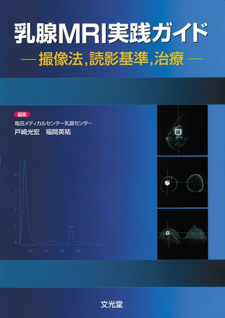 乳腺MRI実践ガイド | 株式会社文光堂