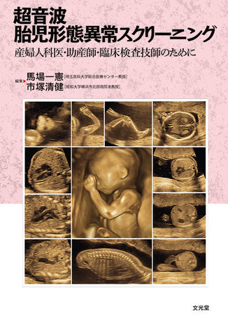 超音波胎児形態異常スクリーニング 株式会社文光堂