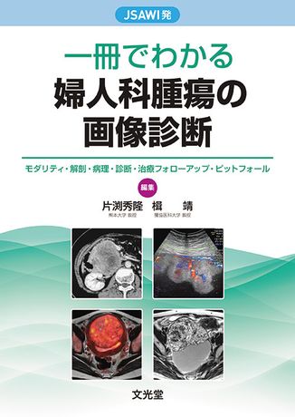 一冊でわかる婦人科腫瘍の画像診断 | 株式会社文光堂