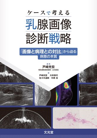 ケースで考える乳腺画像診断戦略 | 株式会社文光堂