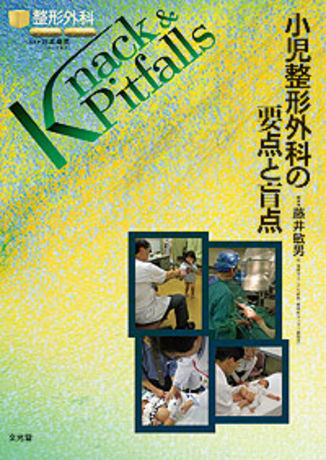 小児整形外科の要点と盲点 | 株式会社文光堂