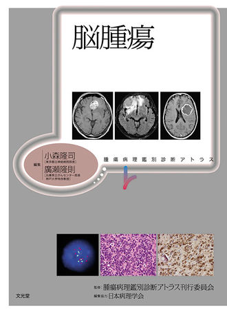 脳腫瘍 | 株式会社文光堂