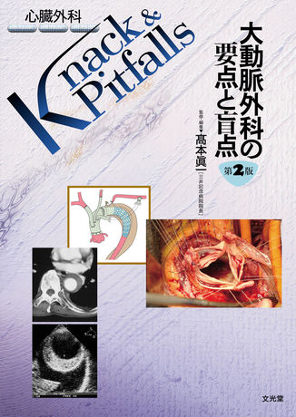 大動脈外科の要点と盲点 | 株式会社文光堂